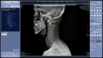 Rayence Xmaru Chiroview